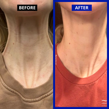 Dr. Melaxin | Neck Wrinkle Removal Set