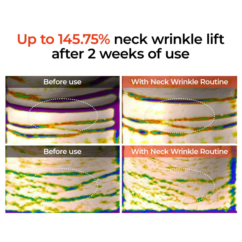 Dr. Melaxin | Neck Wrinkle Removal Set